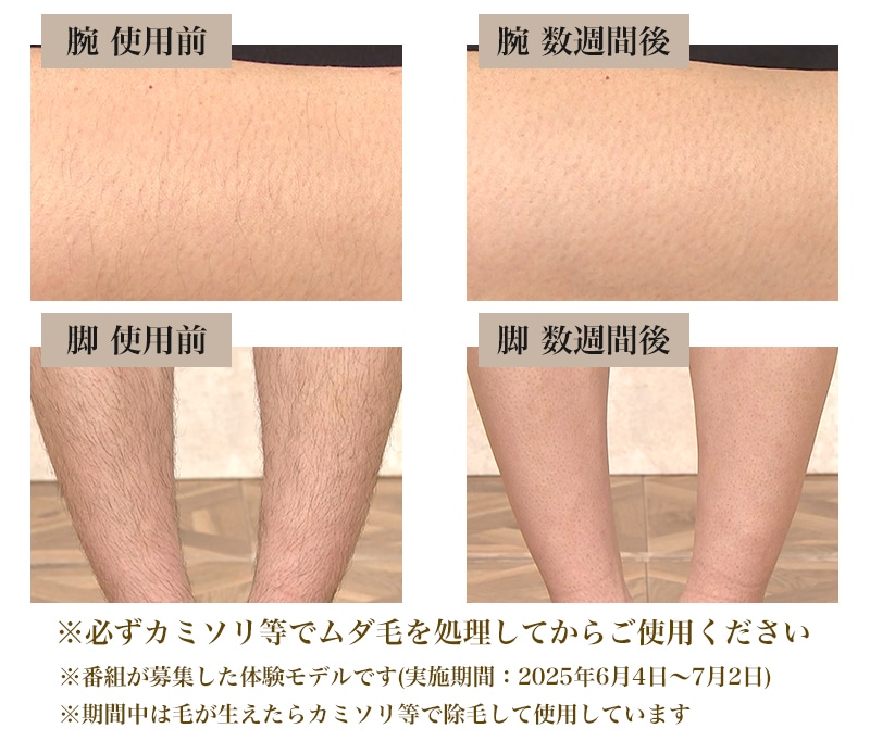 ReFa EPI GO 使用前　使用後