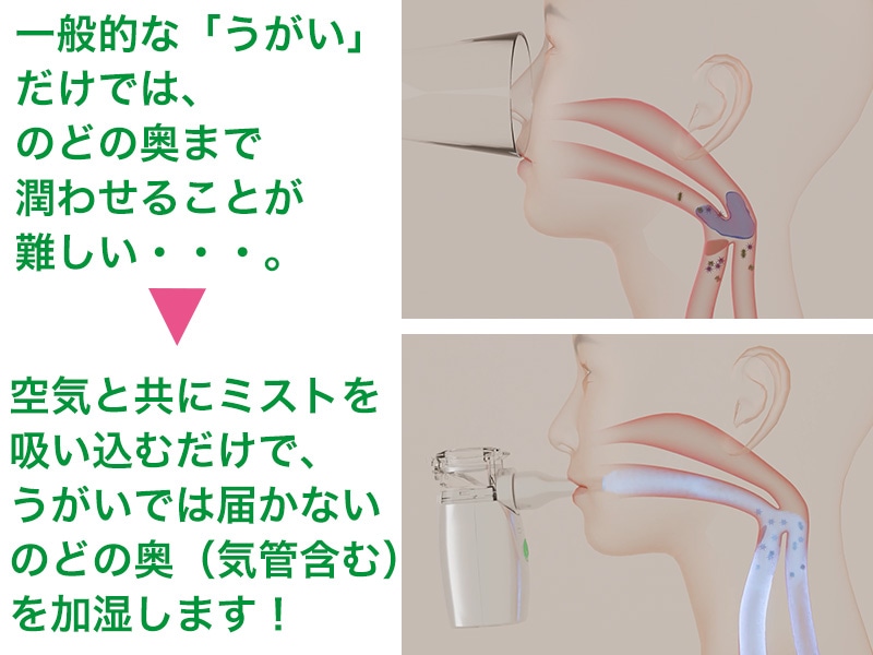 メディサナ 家庭用超音波吸入器: 美容・健康｜いちばん本舗オンライン